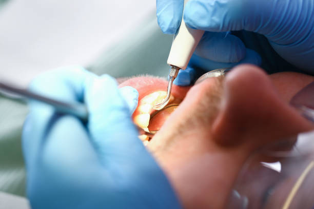 Best Broken or Cracked Tooth Emergency Dentist in Montrose, MI