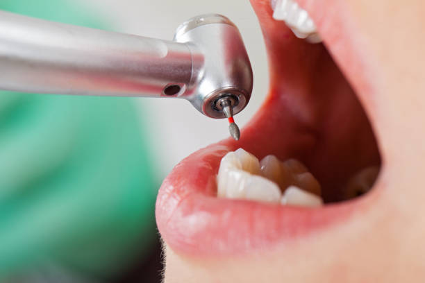 Best Emergency Dental Services for Seniors in Montrose, MI